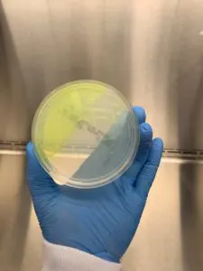 microbial impurity testing through petrifilm and plating